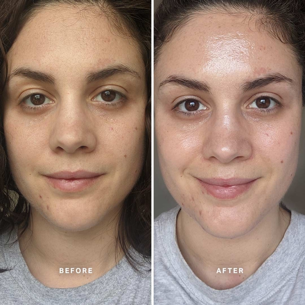 🆕️✨️Alpha-H Liquid Gold with Glycolic Acid - Picture 5 of 16